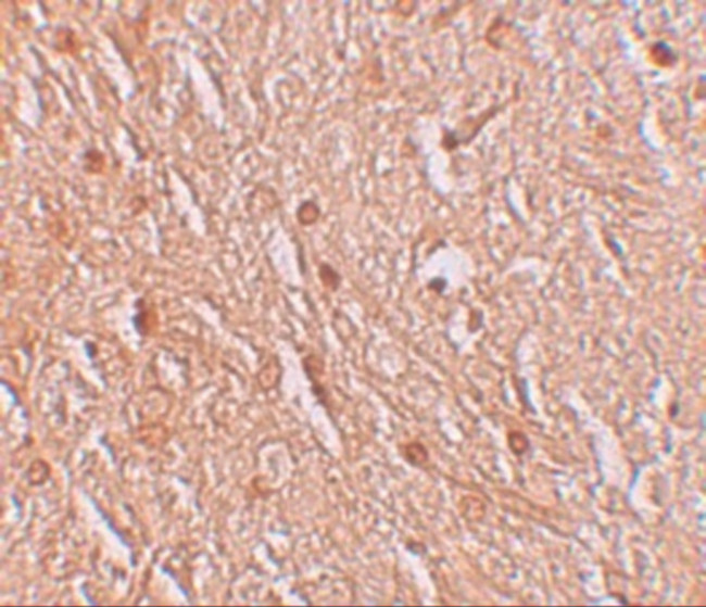 LMBRD1 Antibody in Immunohistochemistry (IHC)