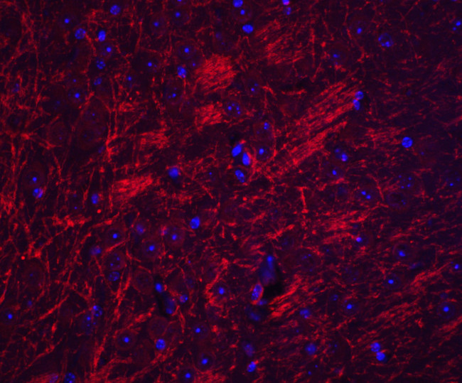 SYNPO Antibody in Immunohistochemistry (IHC)