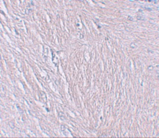 SYNPO Antibody in Immunohistochemistry (IHC)