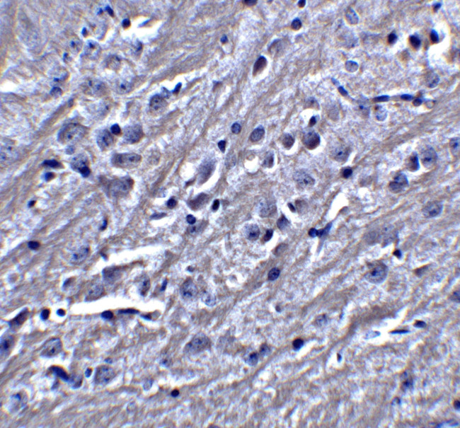 SYNPO Antibody in Immunohistochemistry (IHC)