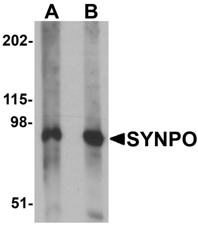 SYNPO Antibody in Western Blot (WB)