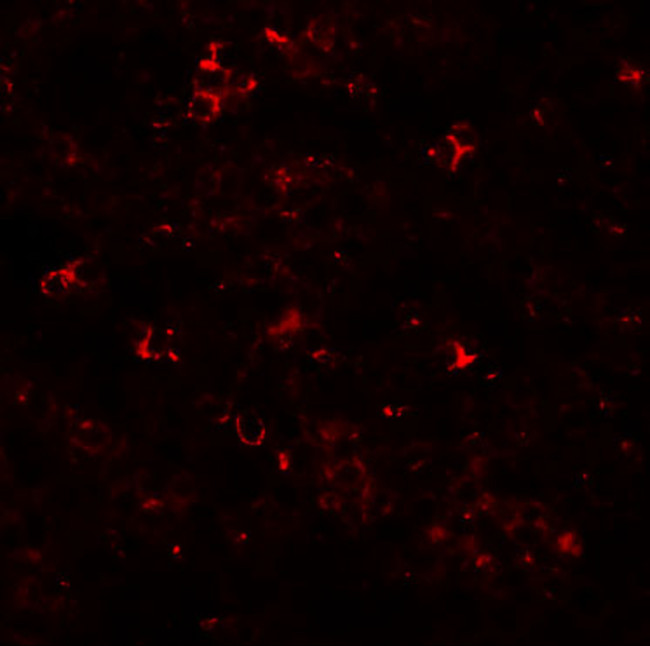 ZIP10 Antibody in Immunohistochemistry (IHC)