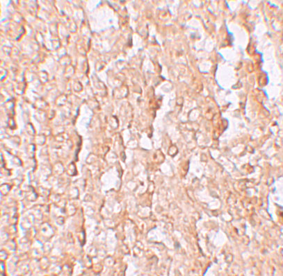 ZIP10 Antibody in Immunohistochemistry (IHC)