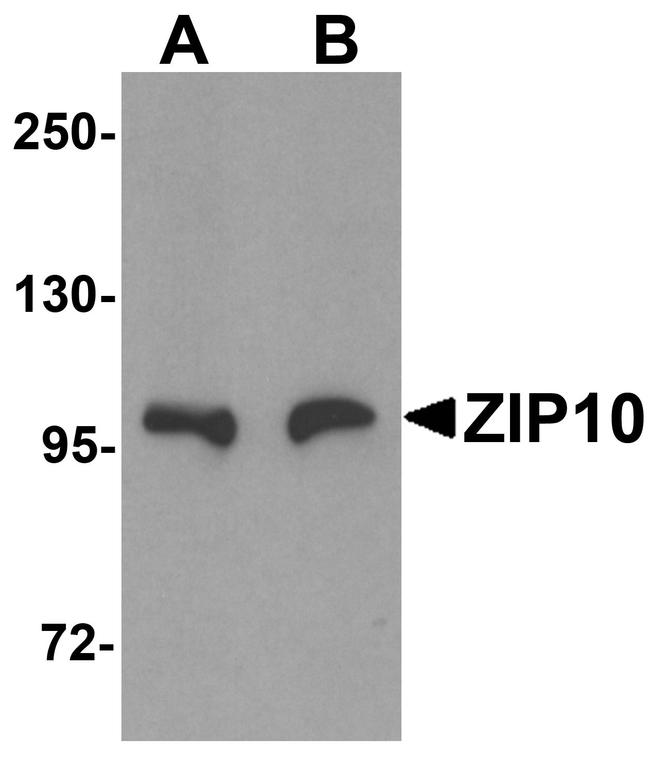 ZIP10 Antibody in Western Blot (WB)