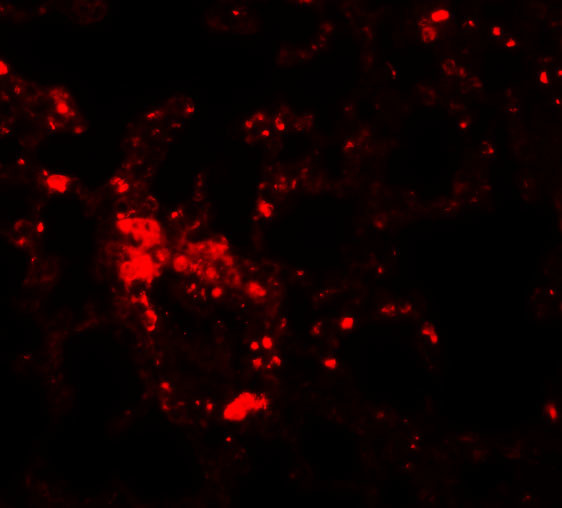 SLC39A6 Antibody in Immunohistochemistry (IHC)