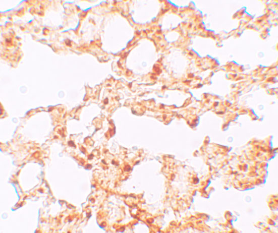 SLC39A6 Antibody in Immunohistochemistry (IHC)