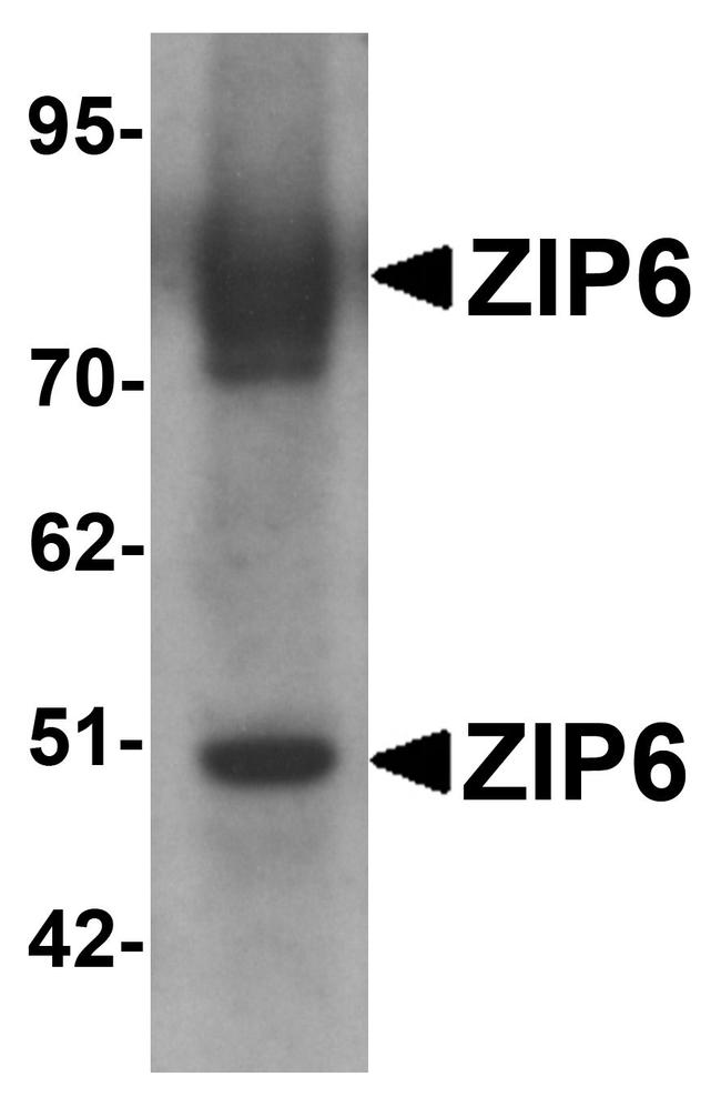 SLC39A6 Antibody in Western Blot (WB)