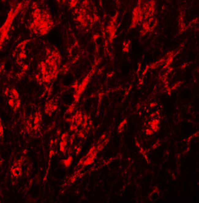 SLC39A9 Antibody in Immunohistochemistry (IHC)