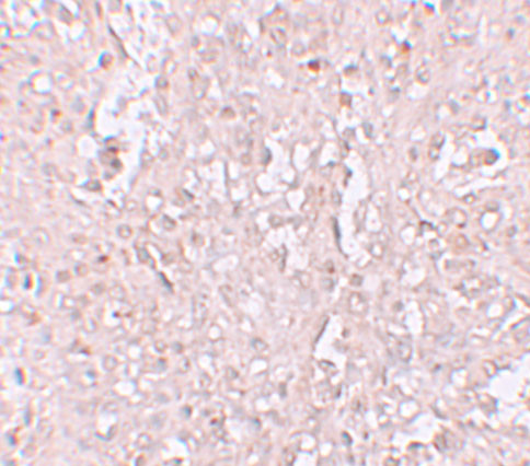 ZIP13 Antibody in Immunohistochemistry (IHC)