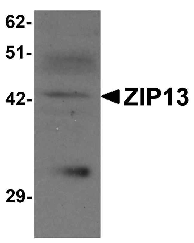 ZIP13 Antibody in Western Blot (WB)