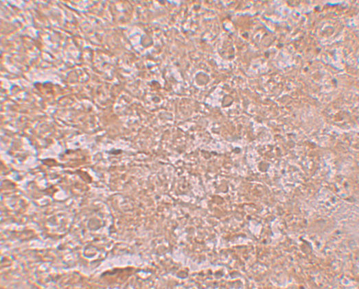 ZIP14 Antibody in Immunohistochemistry (IHC)