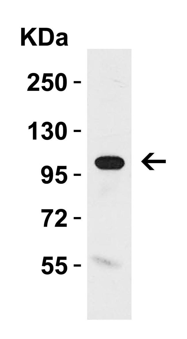 Klotho Antibody in Western Blot (WB)