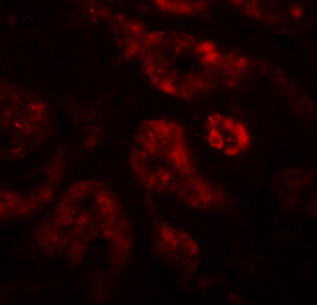 DPF2 Antibody in Immunohistochemistry (IHC)