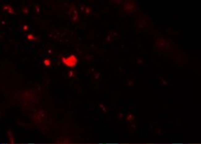 TFF3 Antibody in Immunohistochemistry (IHC)