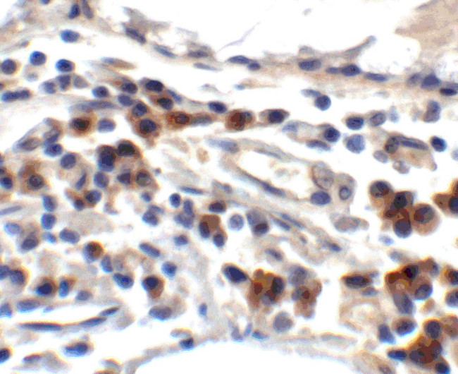 TFF3 Antibody in Immunohistochemistry (IHC)