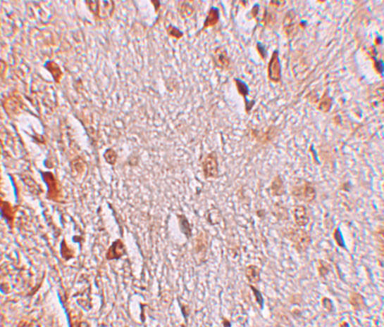 WIZ Antibody in Immunohistochemistry (IHC)