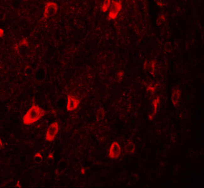 ZBTB3 Antibody in Immunohistochemistry (IHC)