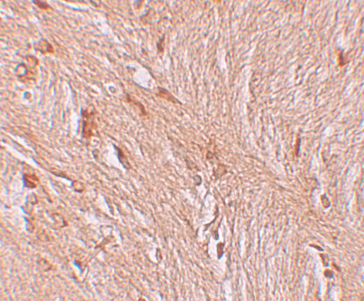 ZBTB3 Antibody in Immunohistochemistry (IHC)