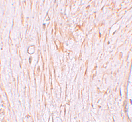 Pokemon Antibody in Immunohistochemistry (IHC)