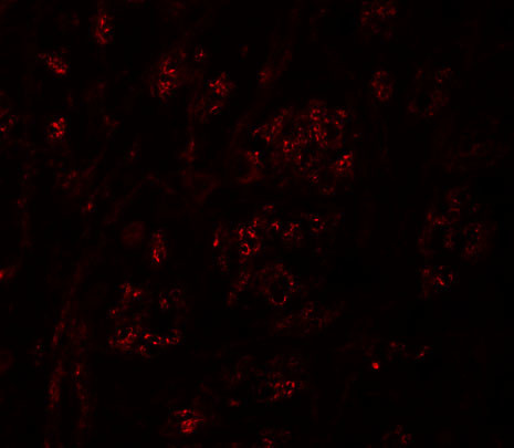 PION Antibody in Immunocytochemistry (ICC/IF)