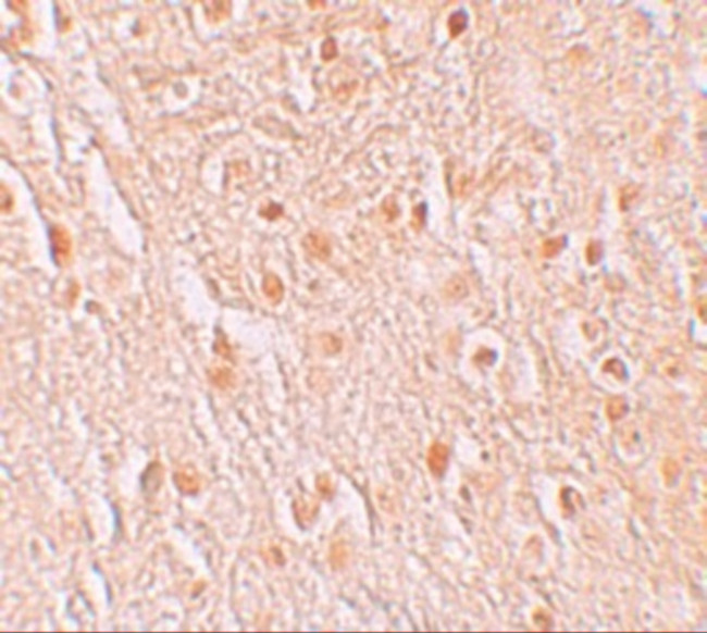 PION Antibody in Immunohistochemistry (IHC)