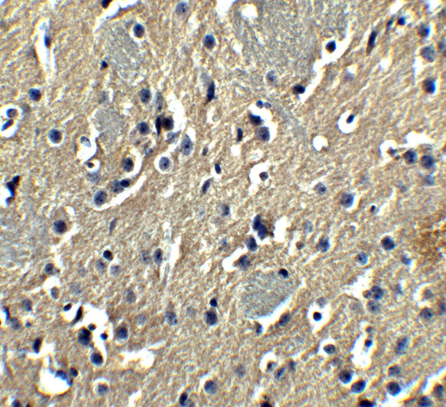 PION Antibody in Immunohistochemistry (IHC)