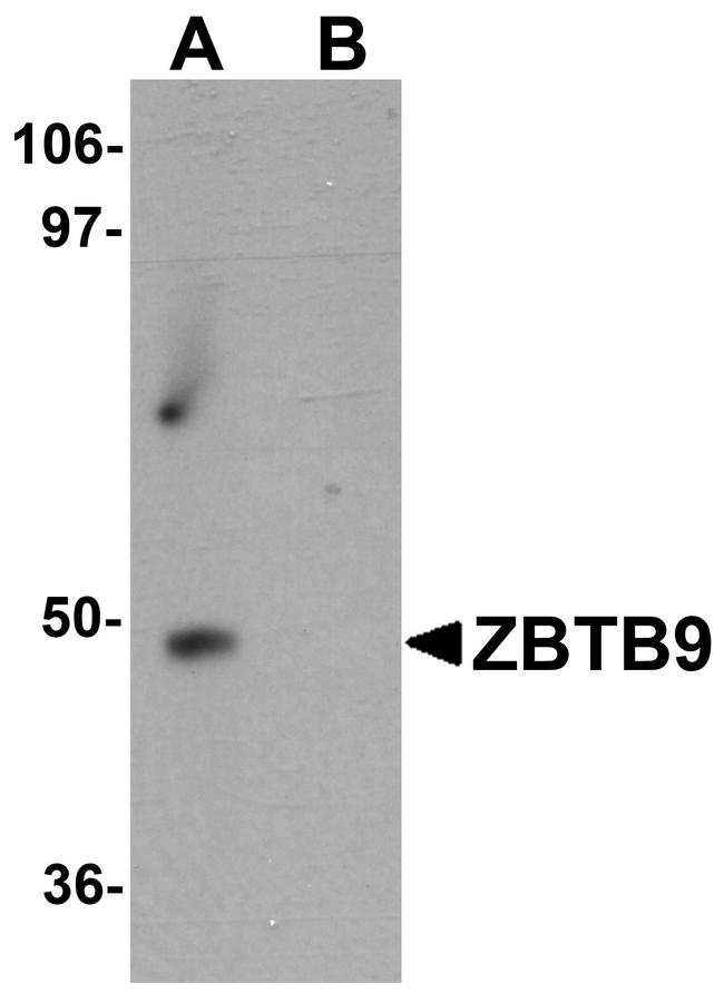 ZBTB9 Antibody in Western Blot (WB)