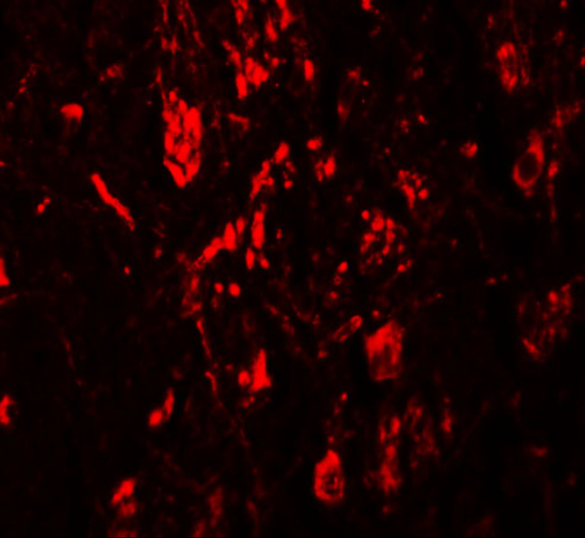 LRRTM4 Antibody in Immunohistochemistry (IHC)