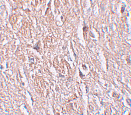 LRRTM4 Antibody in Immunohistochemistry (IHC)