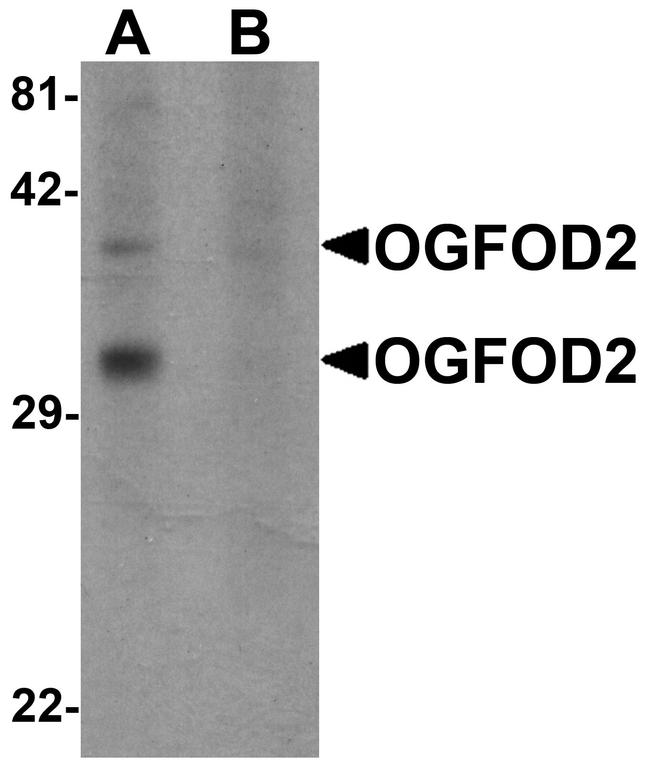 OGFOD2 Antibody in Western Blot (WB)