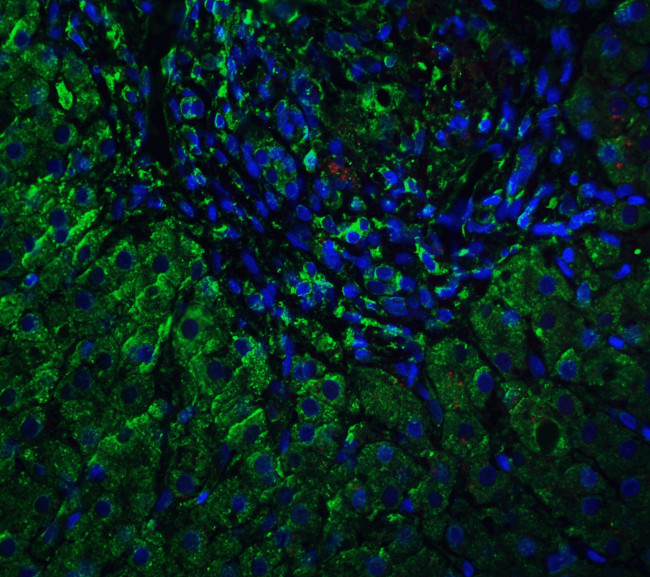 VPS39 Antibody in Immunohistochemistry (IHC)