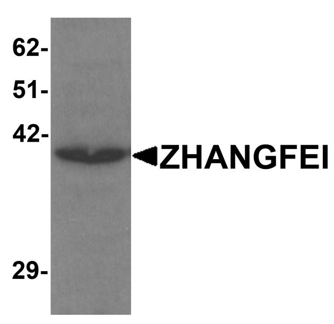 CREBZF Antibody in Western Blot (WB)