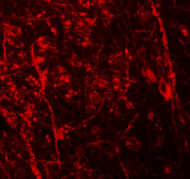 Nkx3.2 Antibody in Immunohistochemistry (IHC)