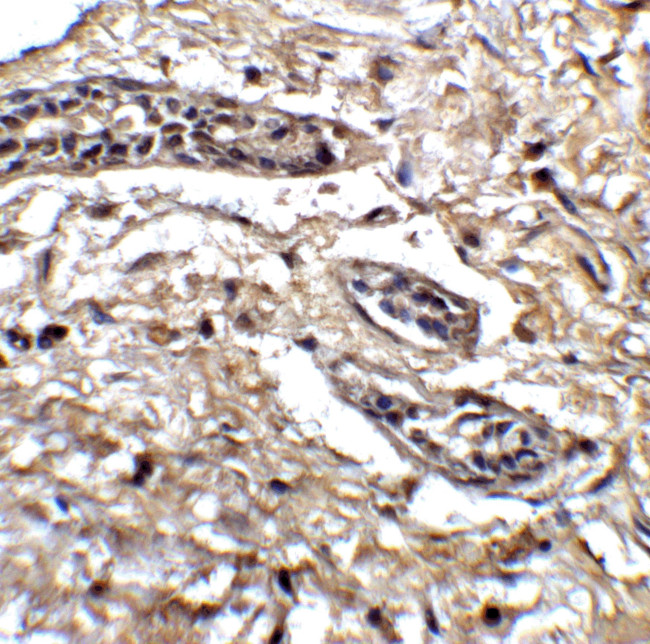 BCL9L Antibody in Immunohistochemistry (IHC)