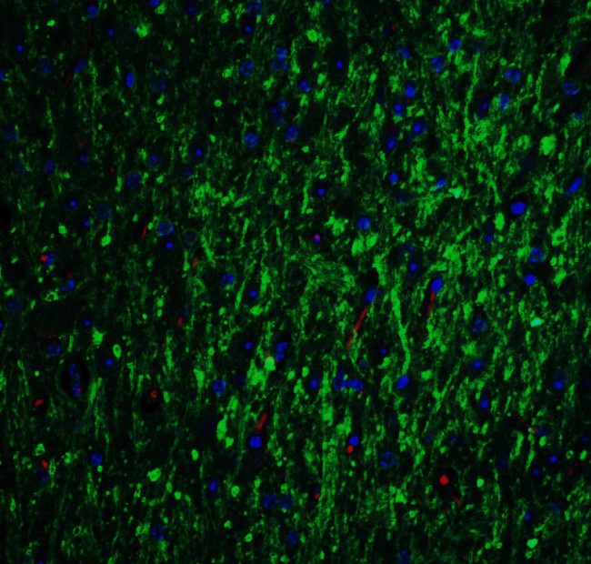 GLS2 Antibody in Immunohistochemistry (IHC)