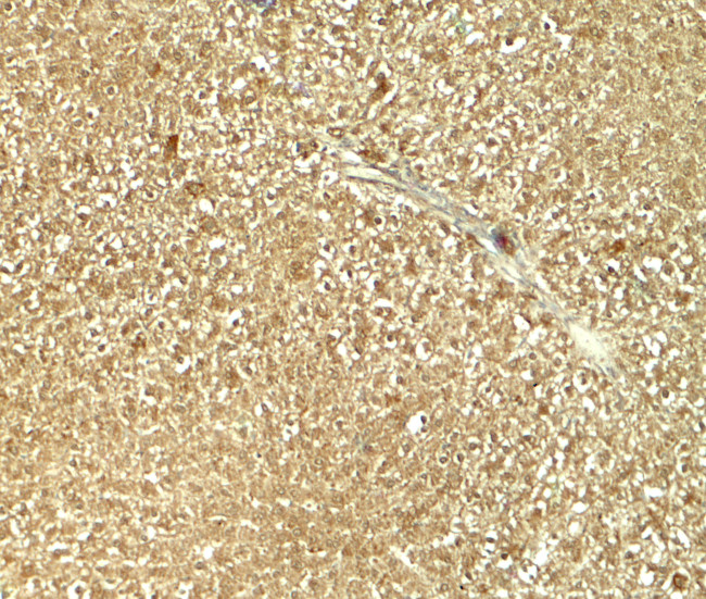 GLS2 Antibody in Immunohistochemistry (IHC)