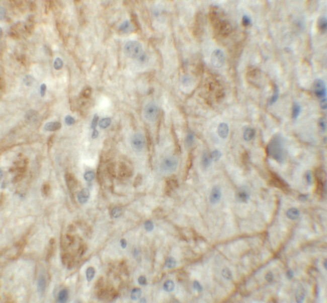 ZNF219 Antibody in Immunohistochemistry (IHC)