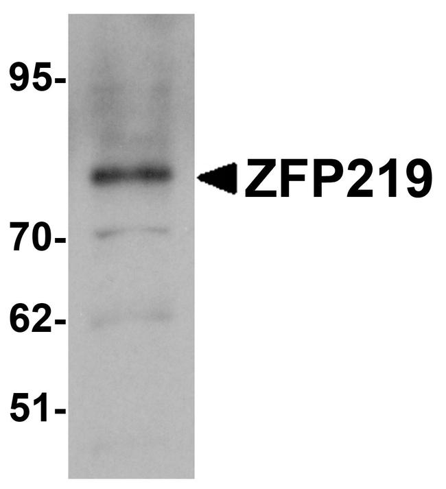 ZNF219 Antibody in Western Blot (WB)