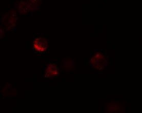 LIF Antibody in Immunocytochemistry (ICC/IF)