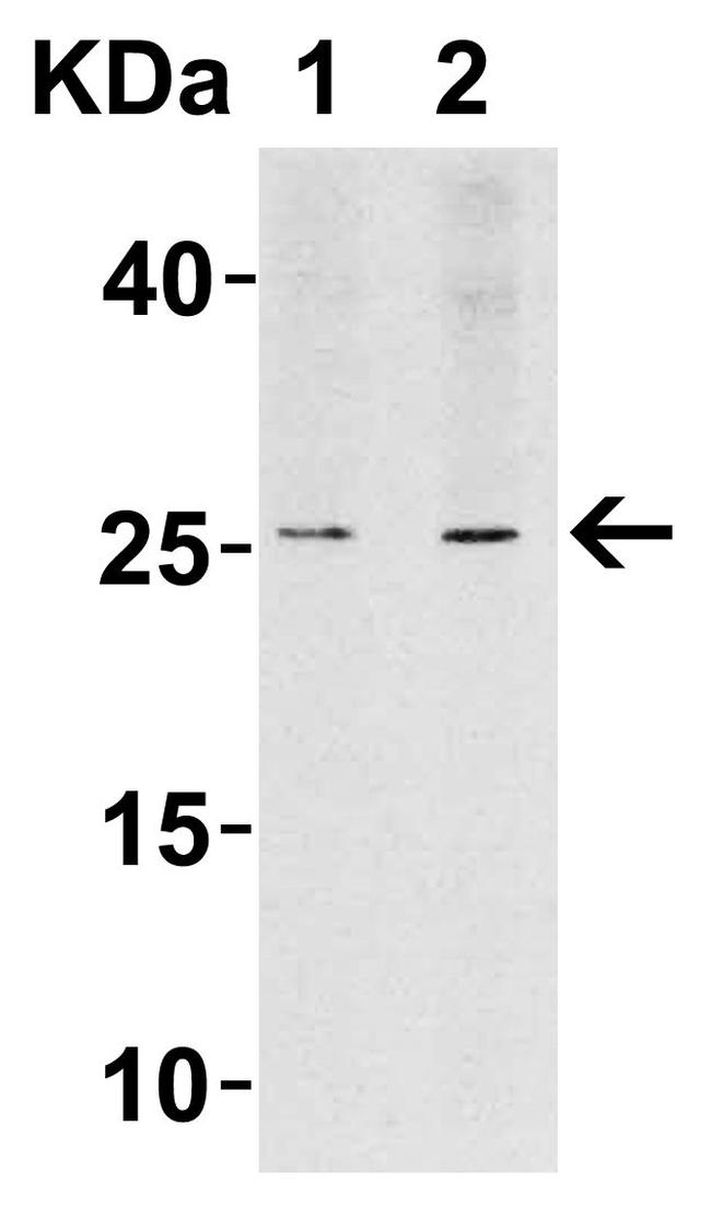 LIF Antibody in Western Blot (WB)