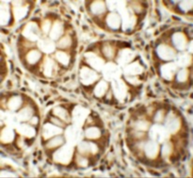 CD150 Antibody in Immunohistochemistry (IHC)