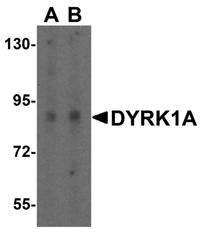 DYRK1A Antibody in Western Blot (WB)