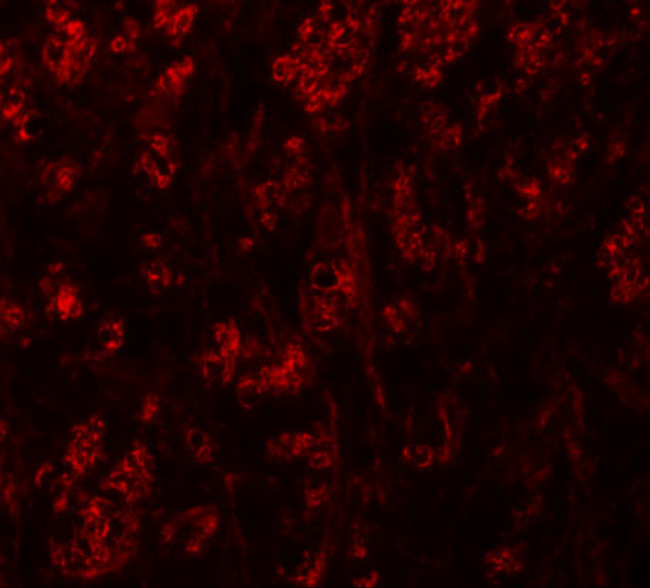 ATP2C1 Antibody in Immunohistochemistry (IHC)