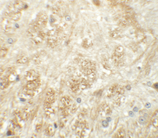 ATP2C1 Antibody in Immunohistochemistry (IHC)