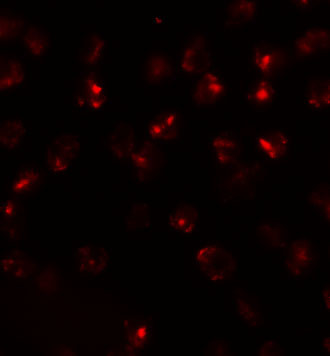 ATP2C2 Antibody in Immunocytochemistry (ICC/IF)