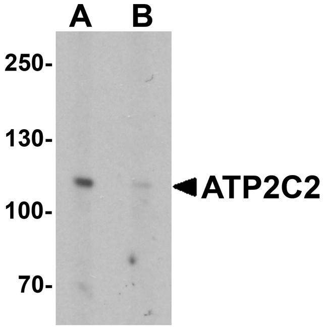 ATP2C2 Antibody in Western Blot (WB)