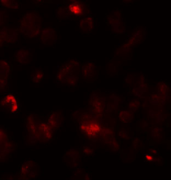 ROCK1 Antibody in Immunocytochemistry (ICC/IF)