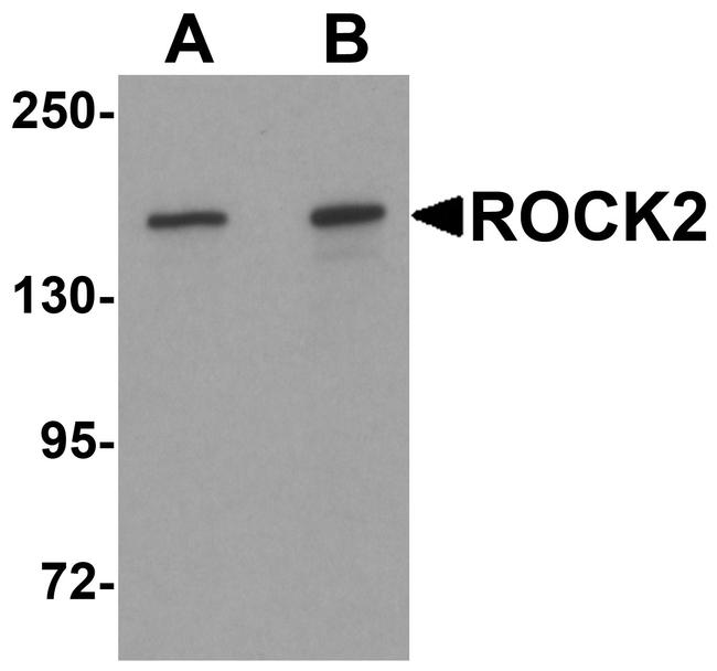 ROCK2 Antibody in Western Blot (WB)