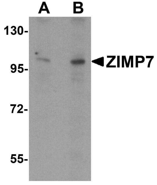 ZMIZ2 Antibody in Western Blot (WB)