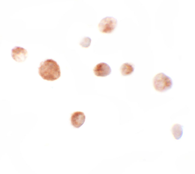 ZMIZ1 Antibody in Immunocytochemistry (ICC/IF)